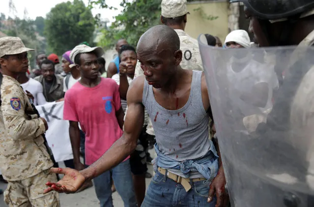 A man bleeds after being hit in the head, near the home of Haiti's President Jovenel Moise, during a march called by opposition parties and civil society to protest against the government in Port-au-Prince, Haiti, June 9, 2019. (Photo by Andres Martinez Casares/Reuters)