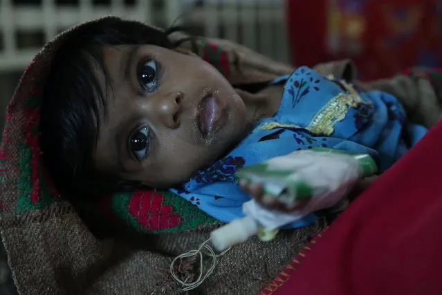 A child affected from famine waits to get medical treatment in Tharparkar, Sindh province, Pakistan, 27 January 2015. Reports state that some 47 people, most of them infants, died in January due to malnutrition in the famine-hit area of the Sindh province. (Photo by Rehan Khan/EPA)