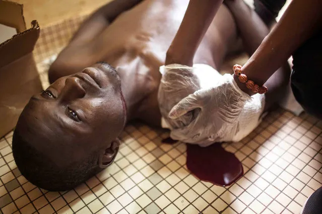 A protestor that was shot during clashes, is treated in hospital in Ouagadougou, Burkina Faso, Thursday, September 17, 2015. While gunfire rang out in the streets, Burkina Faso’s military took to the airwaves Thursday to declare it now controls the West African country, confirming that a coup had taken place just weeks before elections. (Photo by Theo Renaut/AP Photo)