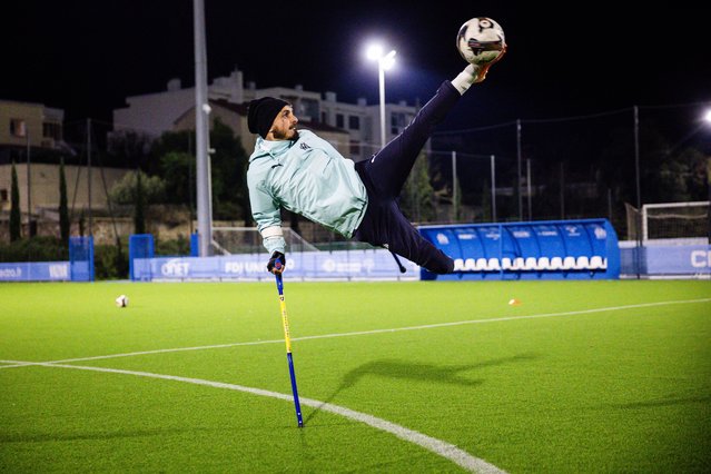 Billy Lunaschi of the Olympic de Marseille (OM) "Football for amputee" team takes part in a training session at the “OM Campus” in Marseille, southeastern France, on November 22, 2025. Accidents or illness may have taken a leg or a hand from them, but not their desire or joy to play football at a high level: on the weekend of November 29, 2025, OM's amputee team begins the French championship at home, dreaming of the Champions League. (Photo by Clement Mahoudeau/AFP via Getty Images)