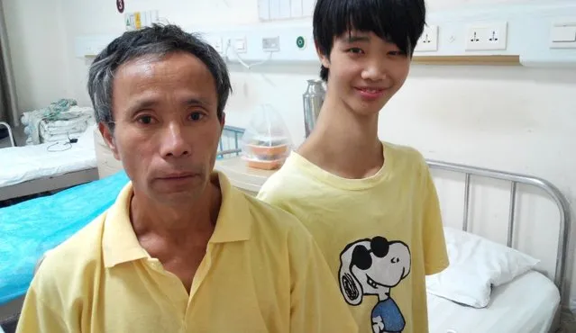 Chinese Teenager With Unusually Long Neck