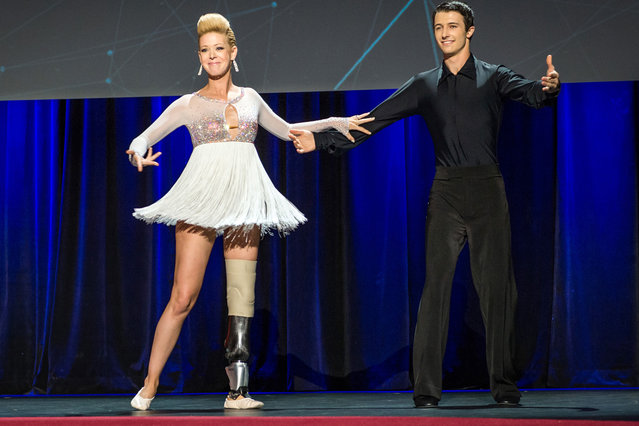 In this photo provided by TED 2014 Conference, dancer Adrianne Haslet-Davis, left, performs on stage with dancer Christian Lightner at the 2014 TED Conference, in Vancouver, British Columbia, on March 19, 2014. Haslet-Davis took to the stage with a new prosthetic limb to perform for the first time since losing part of her left leg in the 2013 Boston Marathon bombing. (Photo by James Duncan Davidson/AP Photo/TED 2014 Conference)