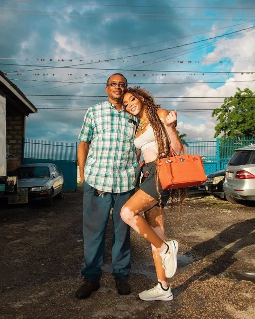 Canadian fashion model Winnie Harlow spends some time with her dad in Jamaica in the first decade of August 2022. (Photo by winnieharlow/Instagram)
