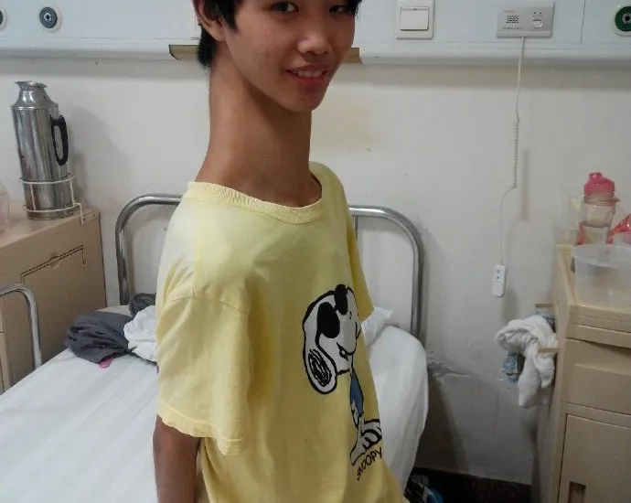 Chinese Teenager With Unusually Long Neck
