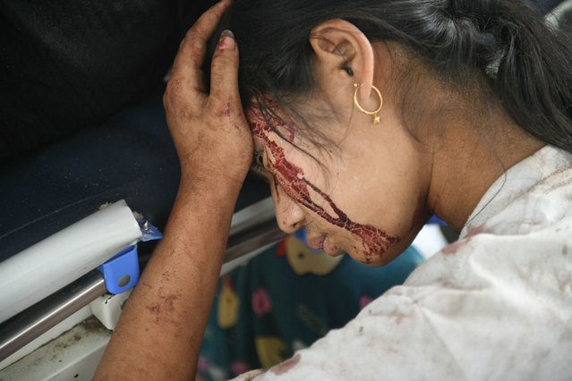 Blood is seen on the face of an earthquake survivors as she rests in a hospital in Naypyidaw on March 28, 2025, after an earthquake in central Myanmar. A powerful earthquake rocked central Myanmar on March 28, buckling roads in capital Naypyidaw, damaging buildings and forcing people to flee into the streets in neighbouring Thailand. (Photo by Sai Aung Main/AFP Photo)