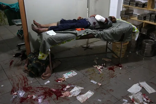 A wounded Syrian man is seen at a make shift hospital following government bombardment in Kafr Batna in the rebel-held enclave of Eastern Ghouta on March 11, 2018. New air strikes and barrel bombs pounded Syria's Eastern Ghouta as government forces pressed a three-week advance that splintered the rebel enclave and trapped dozens under collapsed buildings. (Photo by Ammar Suleiman/AFP Photo)