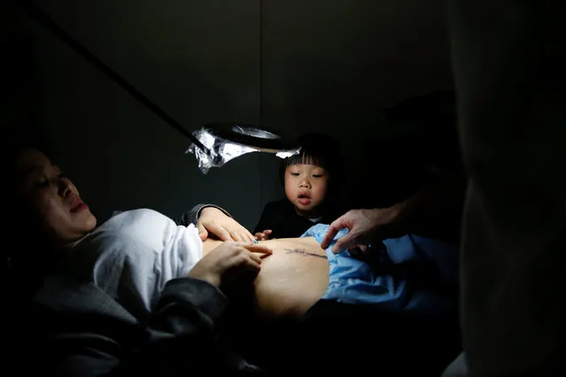 Grace Yuan's 3-year-old daughter Rebecca, looks at the caesarean delivery (C-section) scar on her mother's belly, which is being worked on by a tattoo artist, at Samurai Tattoo in Shanghai, China, April 26, 2017. Yuan's daughter thinks the scar is ugly, making Yuan want to cover it up. As a dance teacher, she feels awkward when the scar is exposed as she wears dancing costumes. “Now I feel more confident after getting this tattoo. I can dance freely on the stage without worries or awkwardness”, said Yuan. (Photo by Aly Song/Reuters)