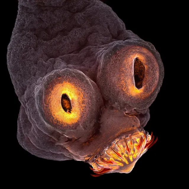 The 4th place winner shows the everted scolex (head) of a tapeworm magnified 200x. (Photo by Teresa Zgoda/2017 Nikon Small World Photomicrography Competition)