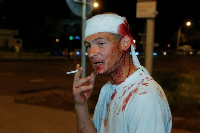 An injured man smokes a cigarette as he attends a rally following the presidential election in Minsk, Belarus on August 10, 2020. (Photo by Vasily Fedosenko/Reuters)