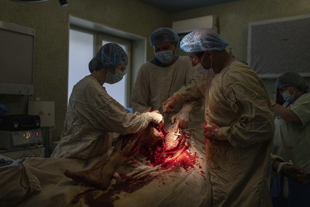 Surgeons amputate the leg of a wounded Ukrainian serviceman at Mechnikov Hospital in Dnipro, Ukraine, Friday, July 14, 2023. A surge of wounded soldiers has coincided with the major counteroffensive Ukraine launched last month to try to recapture its land from Russian forces. Surgeons at Mechnikov Hospital, one of the country's biggest, are busier now than perhaps at any other time since Russia began its invasion 17 months ago. (Photo by Evgeniy Maloletka/AP Photo)