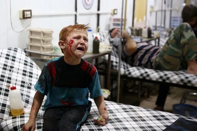 Salam, an injured eight-year-old Syrian boy, cries as he waits for medical care at a makeshift clinic after a reported air strike on July 16, 2016 in al-Rehan, near Douma, a rebel-held town east of the capital Damascus. (Photo by Abd Doumany/AFP Photo)