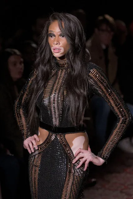 Canadian model Winnie Harlow wears a creation by designer Julien Macdonald during his Autumn/Winter 2017 show, as part of London Fashion Week, Saturday, February 18, 2017. (Photo by Joel Ryan/Invision/AP Photo)