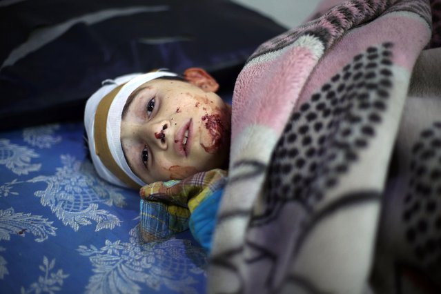 A wounded Syrian boy looks on at a makeshift hospital, following reported Syrian government air strikes on the rebel-held town of Arbin in the eastern Ghouta region on the outskirts of the capital Damascus, on May 9, 2016. (Photo by Amer Almohibany/AFP Photo)
