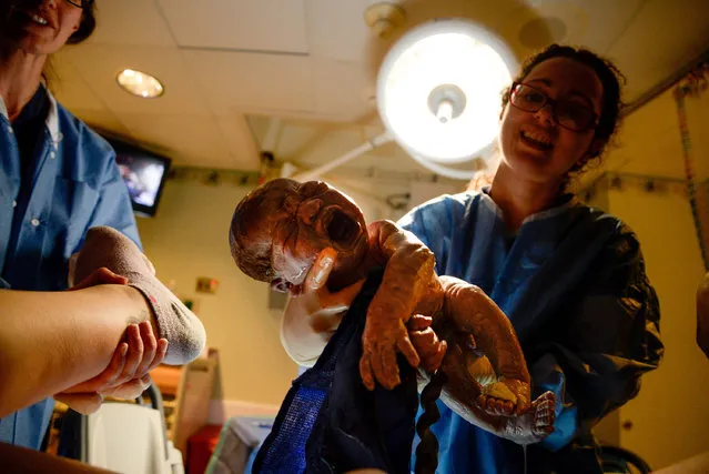 Lauren gets the photo she wanted as doctors bring Kai into the world on January 30, 2017 in New York. This mother was so keen to not miss a minute of her sons birth that she photographed it herself. Lauren Chenault, aged 24, pictured the magical moment her son Kai Arthur came in to the world, with the help of friends and family. The photographer and stay at home mum, who also has a one-year-old daughter Kailah, gave birth Kai, who was 8lb 3oz on January 31. Lauren, of New York, held the camera on her stomach for most of the birth and said she “just kept pressing the button” to get the perfect shot. (Photo by Fortitude Press/Barcroft Images)