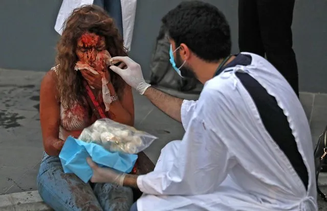 A wounded woman receives help outside a hospital following an explosion in the Lebanese capital Beirut on August 4, 2020. Two huge explosion rocked the Lebanese capital Beirut, wounding dozens of people, shaking buildings and sending huge plumes of smoke billowing into the sky. Lebanese media carried images of people trapped under rubble, some bloodied, after the massive explosions, the cause of which was not immediately known. (Photo by Ibrahim Amro/AFP Photo)