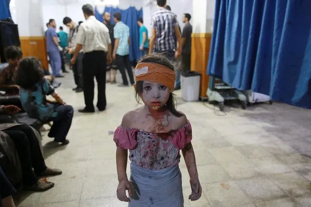 A wounded Syrian girl looks on at a make shift hospital in the rebel-held area of Douma, east of the capital Damascus, following shelling and air raids by Syrian government forces on August 22, 2015. (Photo by Abd Doumany/AFP Photo)