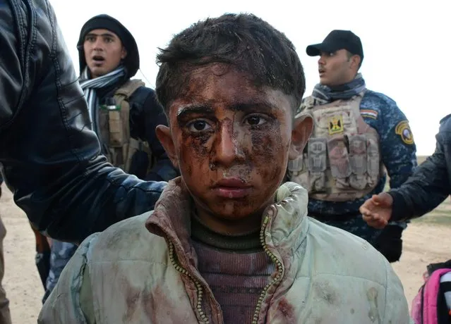 An injured Iraqi boy, who fled hunger and jihadist rule in the Iraqi city of Hawijah with his family, recieves assistance from Iraqi security forces in the area of Al-Fatha north of Salaheddin province, on January 9, 2015. (Photo by Mahmud Saleh/AFP Photo)