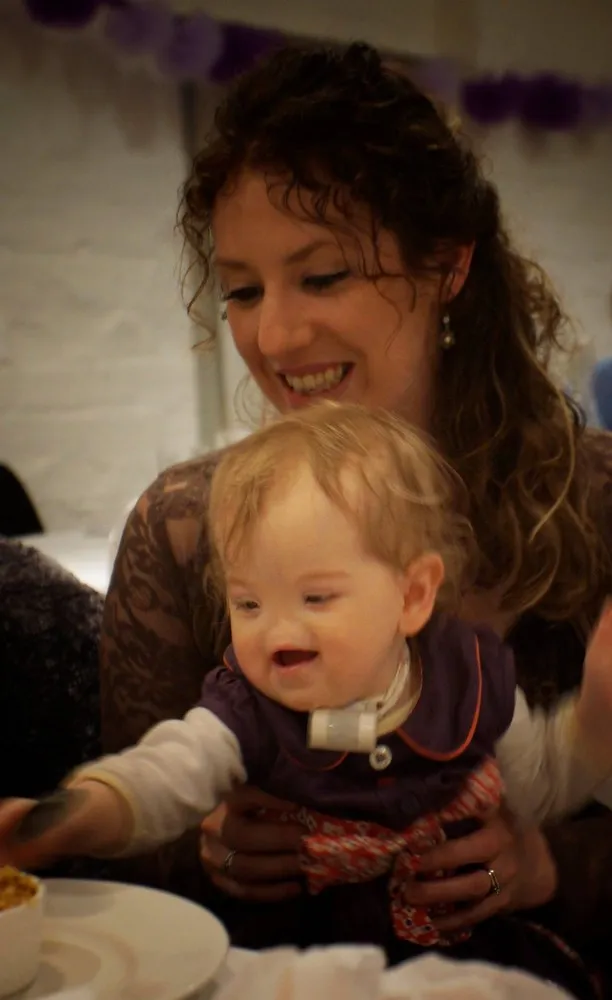 Little Girl without a Nose