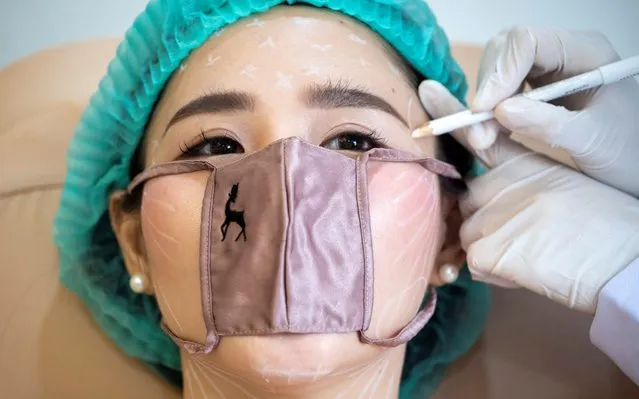 A customer wears a mini face mask during a treatment at the Waleerat beauty clinic after the Thai government eased isolation measures, amid the coronavirus disease (COVID-19) outbreak in Bangkok, Thailand, June 2, 2020. (Photo by Athit Perawongmetha/Reuters)