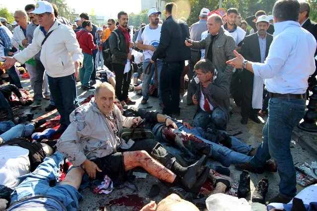 An injured man asks for help after an explosion during a peace march in Ankara, Turkey, October 10, 2015. (Photo by Tumay Berkin/Reuters)