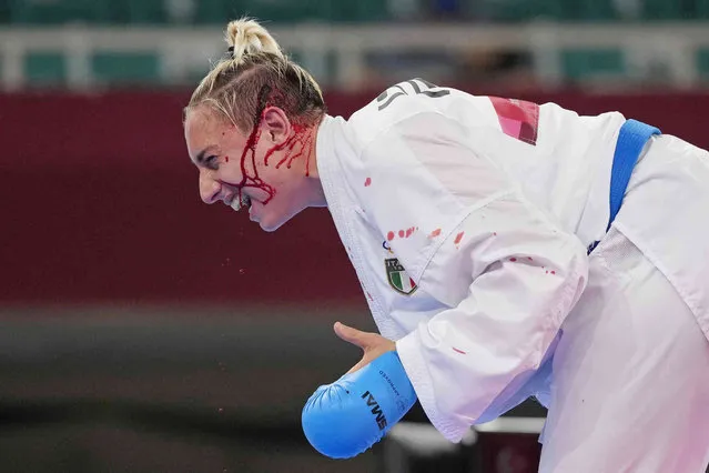 Silvia Semeraro of Italy reacts after being injured while competing against Meltem Hocaoglu Akyol of Turkey in the women's kumite +61kg elimination round for karate at the 2020 Summer Olympics, Saturday, August 7, 2021, in Tokyo, Japan. (Photo by Kin Cheung/AP Photo)
