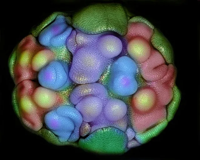 Nikon Small World Photomicrography Competition 2012. 19th Place. “Floral primordia of Allium Sativum (Garlic)”. (Photo by Dr. Somayeh Naghiloo, University of Tabriz, Department of Plant Biology, Faculty of Natural Sciences, Tabriz, East Azarbayedjan, Iran)