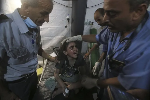 Medics treat a wounded girl at the al Najar hospital following an Israeli airstrike on their family building in Rafah, southern Gaza Strip, Saturday, August 6, 2022. Israeli airstrikes have flattened homes in Gaza and Palestinian rocket barrages into southern Israel are persisting for a second day. (Photo by Hatem Ali/AP Photo)