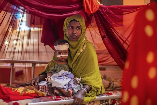 Mother Ayan Muhammed sits with her severely-malnourished baby boy Fahir, as he receives life-saving nutritional treatment, at a UNICEF-supported stabilization center at Gode Hospital in the Shabelle Zone of the Somali region of Ethiopia Tuesday, April 12, 2022. (Photo by Zerihun Sewunet/UNICEF via AP Photo)