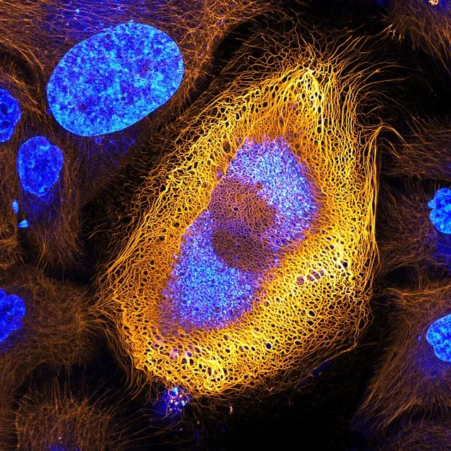 First place: Immortalized human skin cells expressing fluorescently tagged keratin, Amsterdam. (Photo by Bram van den Broek, Andriy Volkov, Kees Jalink, Nicole Schwarz and Reinhard Windoffer/Netherlands Cancer Institute, BioImaging Facility and Department of Cell Biology/2017 Nikon Small World Photomicrography Competition)