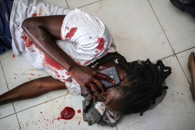 A wounded journalist talks on the phone after being shot by armed gangs at the General Hospital in Port-au-Prince, Haiti, Tuesday, December 24, 2024. (Photo by Jean Feguens Regala/AP Photo)