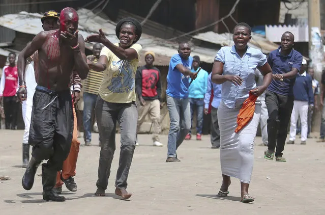 A supporter of Kenyan Opposition leader, Raila Odinga walks through the Mathare slums in Nairobi after being injured by ruling Jubilee Party supporters, Monday, November 20, 2017 after Kenya's Supreme Court on Monday upheld President Uhuru Kenyatta's re-election in a repeat vote that the opposition boycotted while saying electoral reforms had not been made. The decision appeared to put an end to a months-long political drama never before seen in Africa that has left dozens dead. (Photo by Brian Inganga/AP Photo)