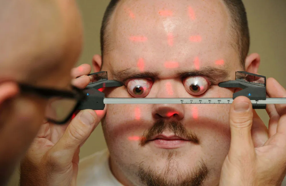 Guiness World Book Of Records: Skull Popping Eyeballs