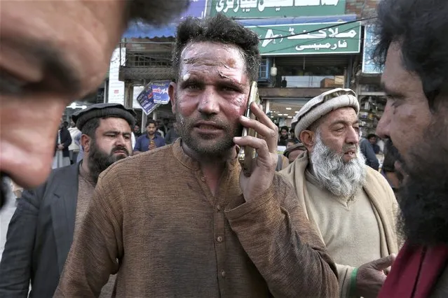 An injured victim of a suicide bombing talks on his mobile phone after getting initial treatment outside a hospital in Peshawar, Pakistan, Monday, January 30, 2023. A suicide bomber struck Monday inside a mosque in the northwestern Pakistani city of Peshawar, killing multiple people and wounding scores of worshippers, officials said. (Photo by Muhammad Sajjad/AP Photo)