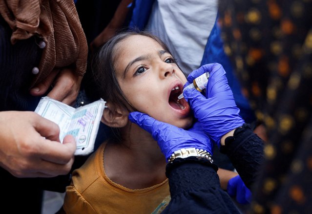 A Palestinian girl is vaccinated against polio, amid the Israel-Hamas conflict, in Khan Younis in the southern Gaza Strip, on September 5, 2024. (Photo by Mohammed Salem/Reuters)