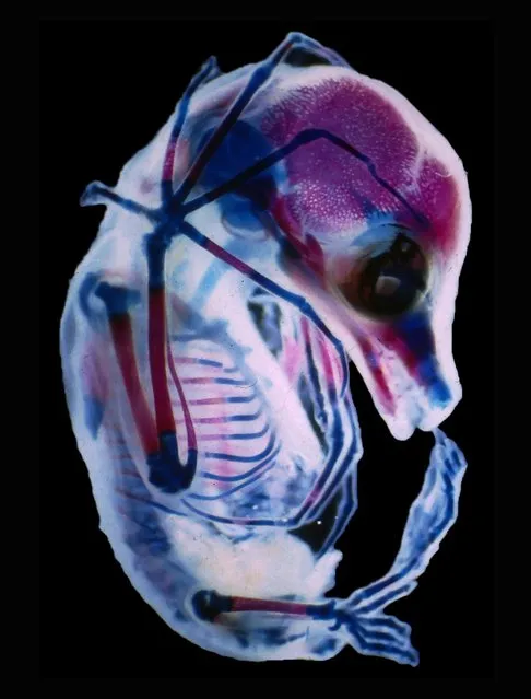 Fifteenth place: Third-trimester fetus of Megachiroptera (fruit bat), Greeley, Colo. (Photo by Rick Adams/University of Northern Colorado, Department of Biological Sciences/2017 Nikon Small World Photomicrography Competition)