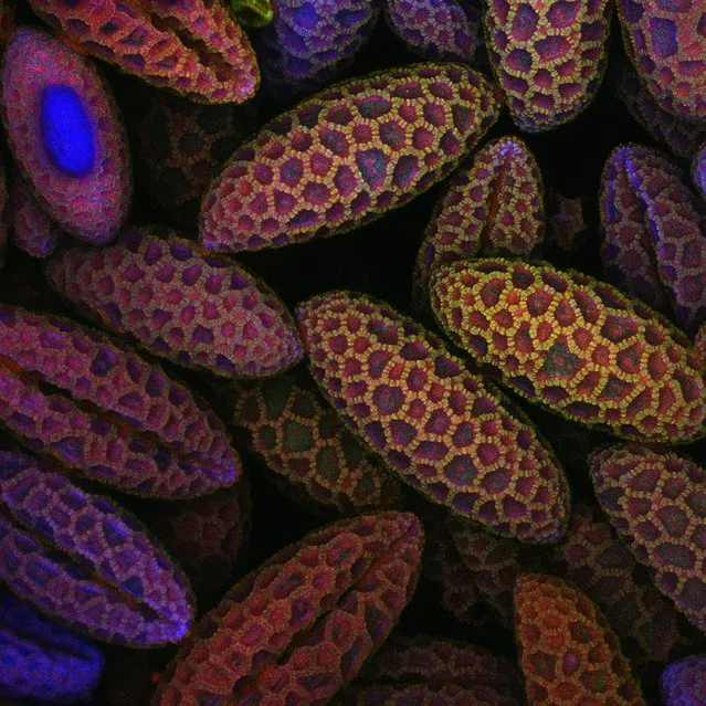 Sixth place: Lily pollen, Southampton, United Kingdom. (Photo by David A. Johnston/University of Southampton/University Hospital Southampton, Biomedical Imaging Unit/2017 Nikon Small World Photomicrography Competition)
