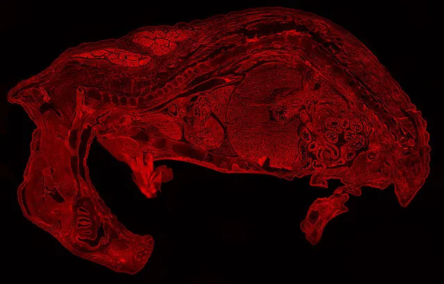 Rat embryo fluorescently labeled with Rhodamine Epi-fluorescence, 10X. Rochester Institute of Technology, Rochester, New York, USA. (Photo by Evan Darling/Nikon Small World 2014)