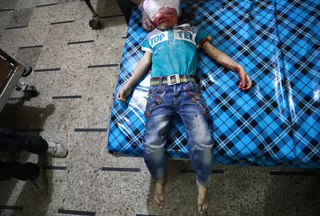 The body of a child is seen at a make-shift hospital following a cluster bomb attack on the rebel-held town of Douma, east of the Syrian capital Damascus, on October 24, 2016. (Photo by Abd Doumany/AFP Photo)