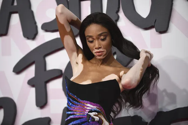 Model Winnie Harlow pose for photographers upon arrival at the Fashion For Relief 2018 event during the 71st international film festival, Cannes, southern France, Sunday, May 13, 2018. (Photo by Arthur Mola/Invision/AP Photo)