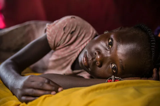 Ten- year- old Angelina Anyanya who has epilepsy lays on a bed at Mahad camp for internally displaced people (IDP) in Juba on April 17, 2018. The camp opened in 2014, shortly after the civil war broke out in the country. Around 7000 people of diverse ethnic backgrounds live in the camp, over 200 of them live with a disability. (Photo by Stefanie Glinski/AFP Photo)