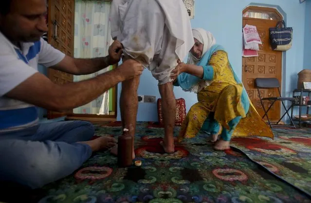 Family members of Kashmiri youth Gulam Rasool Bhat apply medicine on pellet wounds on his body inside his home in Srinagar, Indian controlled Kashmir, Tuesday, August 20, 2019. The president of Pakistani-administered Kashmir welcomed efforts by U.S. President Donald Trump to lower tensions between Pakistan and India over the disputed Himalayan region on Tuesday and warned of a deepening humanitarian crisis and food shortages in the Indian-held portion. (Photo by Mukhtar Khan/AP Photo)