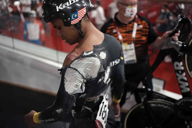Muhammad Shah Firdaus Sahrom of Team Malaysia shows injuries after crashing in the track cycling men's keirin race at the 2020 Summer Olympics, Saturday, August 7, 2021, in Izu, Japan. (Photo by Thibault Camus/AP Photo)