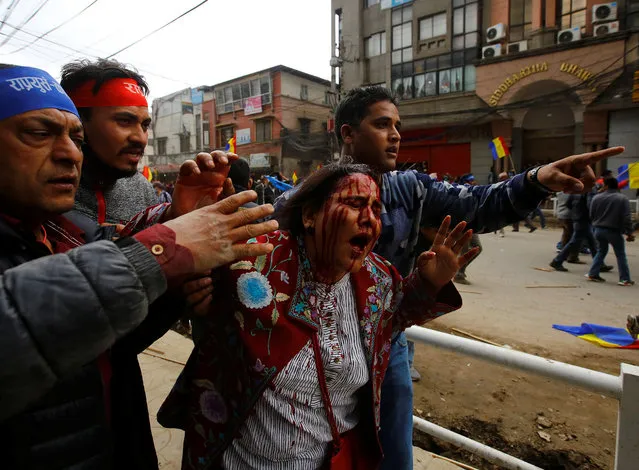 An injured Hindu activist affiliated with Rastriya Prajatantra Party Nepal (RPP-Nepal) is helped by her friends after she was injured in a clash with the riot police personnel during the party's protest after the election commission rejected their campaigning for monarchy and Hinduism, in Kathmandu, Nepal, March 20, 2017. (Photo by Navesh Chitrakar/Reuters)