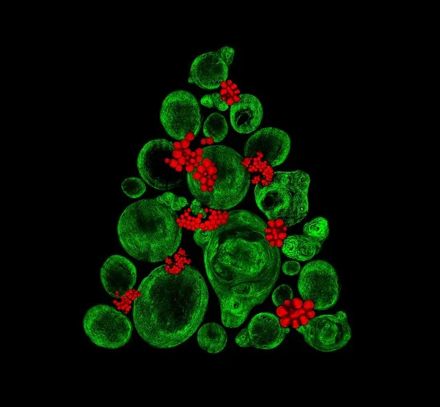 Ninth place: Growing cartilage-like tissue in the lab using bone stem cells (collagen fibers in green and fat deposits in red), Southampton, United Kingdom. (Photo by Catarina Moura, Sumeet Mahajan, Richard Oreffo and Rahul Tare/University of Southampton, Institute for Life Sciences/2017 Nikon Small World Photomicrography Competition)