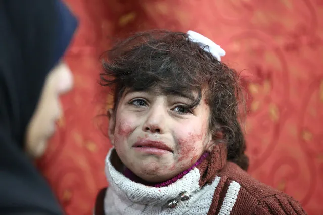 Hala, 9, receives treatment at a makeshift hospital following Syrian government bombardments on rebel-held town of Saqba, in the besieged Eastern Ghouta region on the outskirts of the capital Damascus on February 22, 2018. (Photo by Amer Almohibany/AFP Photo)