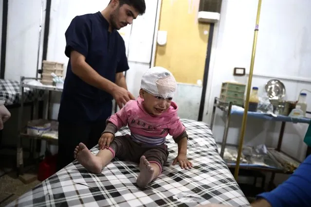 A wounded Syrian child cries as he receives treatment at a make-shift hospital following reported government shelling on the rebel-held town of Douma, east of the Syrian capital Damascus, on October 26, 2016. (Photo by Abd Douman/AFP Photo)