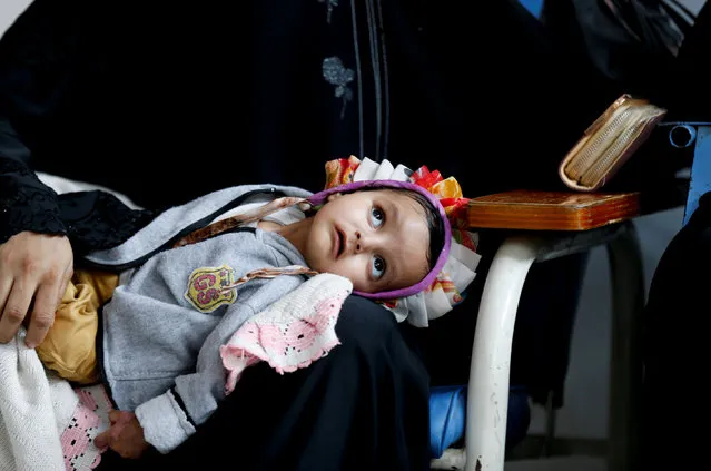 A girl with cancer lies on the lap of her mother at The National Oncology Centre in Sanaa, Yemen, August 6, 2018. (Photo by Khaled Abdullah/Reuters)