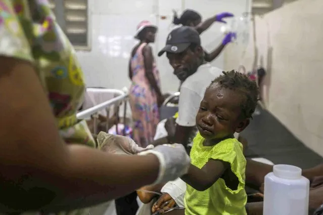 A child injured by the recent 7.2 magnitude earthquake is treated at the Immaculee Conception hospital in Les Cayes, Haiti, Thursday, August 19, 2021. (Photo by Joseph Odelyn/AP Photo)