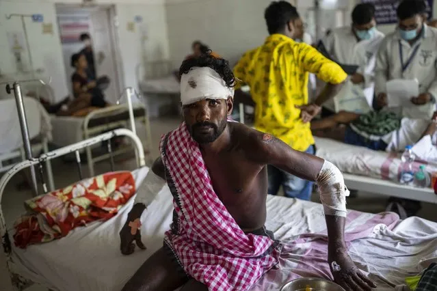 A passenger who was injured in Friday's train accident receives treatment at a hospital in Balasore district, in the eastern state of Orissa, India, Sunday, June 4, 2023. The derailment in eastern India that killed 275 people and injured hundreds was caused by an error in the electronic signaling system that led a train to wrongly change tracks and crash into a freight train, officials said Sunday. (Photo by Rafiq Maqbool/AP Photo)