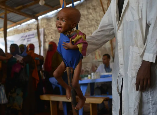 A malnourished child is processed by an aid worker for a UNICEF- funded health programme catering to children displaced by drought, at a facility in Baidoa town, the capital of Bay region of south- western Somalia where the spread of cholera has claimed tens of lives of IDP' s compounding the impact of drought on March 15, 2017 The United Nations is warning of an unprecedented global crisis with famine already gripping parts of South Sudan and looming over Nigeria, Yemen and Somalia, threatening the lives of 20 million people. For Somalis, the memory of the 2011 famine which left a quarter of a million people dead is still fresh. (Photo by Tony Karumba/AFP Photo)